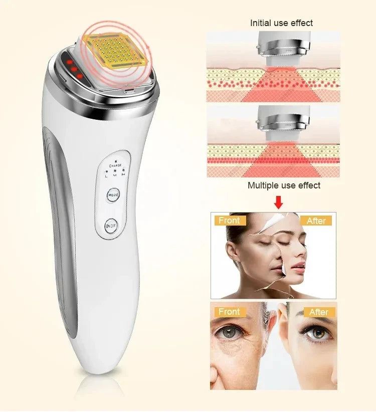 RF Face Lifting Device